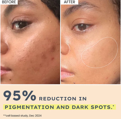 Hyphen 44% Rice Water Brightening Serum Pads - 50 pcs